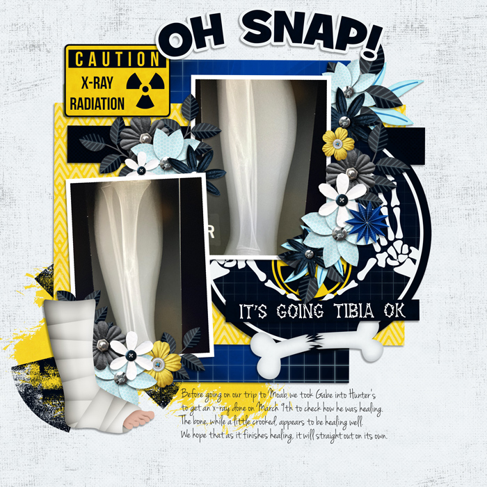 Gabe600-xray-Tinci_SIE11_2