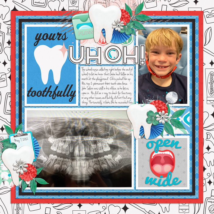 Gabe700mouth-accident-Tinci_CM13_1-Recovered