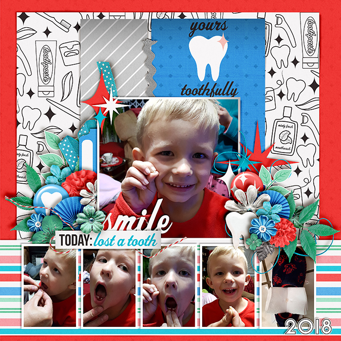 Mike_s-tooth-700-494