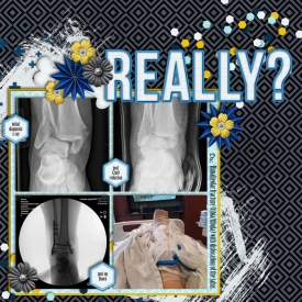 AnkleFracture_web.jpg